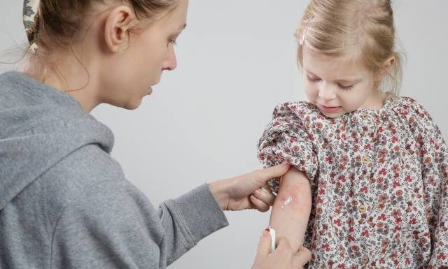 Jak sprawdzić, czy dziecko ma atopowe zapalenie skóry? Zwróć uwagę na te objawy. Poznaj metody leczenia i dietę dla dzieci z AZS