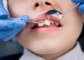 Co przysługuje dzieciom na NFZ u dentysty? Te zabiegi wykonasz u stomatologa bez dodatkowej opłaty