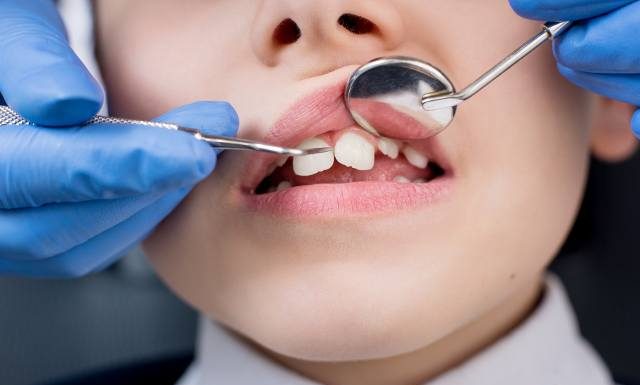 Co przysługuje dzieciom na NFZ u dentysty? Te zabiegi wykonasz u stomatologa bez dodatkowej opłaty