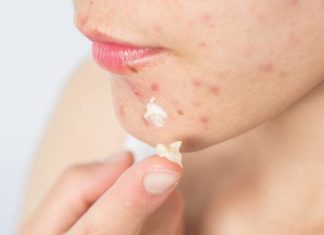 Rakotwórczy związek w kosmetykach na trądzik. Stosujesz ten składnik? W twojej łazience może być wysokie stężenie toksyny