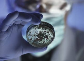 4 śmiertelne choroby, które powrócą w 2024 roku! Niektóre z nich już są w Europie. Docierają do nas niepokojące wiadomości