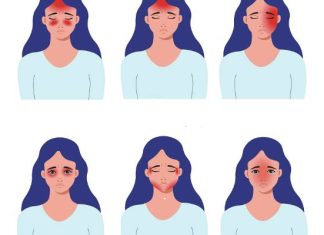 Mapa bólu głowy. Co oznacza ból głowy w danym miejscu? Naucz się rozpoznawać rodzaje bólu głowy po ich umiejscowieniu