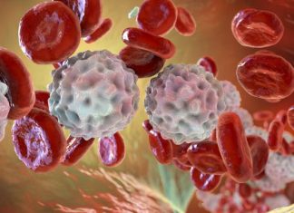 Wreszcie postęp w leczeniu chłoniaków. To nadzieja dla tysięcy chorych