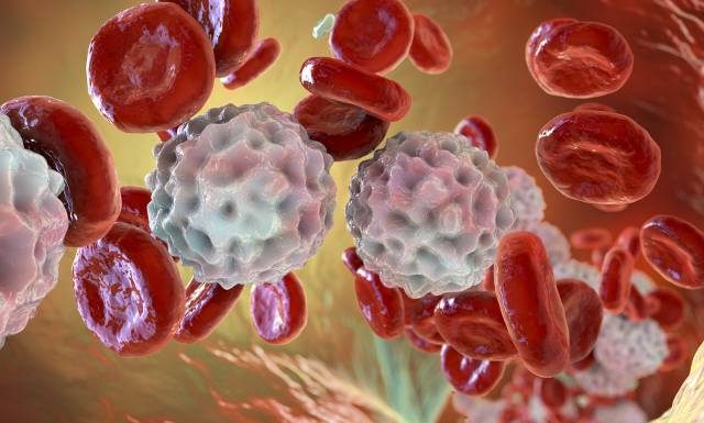 Wreszcie postęp w leczeniu chłoniaków. To nadzieja dla tysięcy chorych