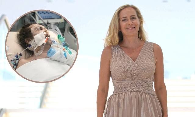 Miała tykającą bombę w głowie. Znana aktorka jest w ciężkim stanie. Pękł jej tętniak mózgu. To może przydarzyć się każdemu. Jak go uniknąć?