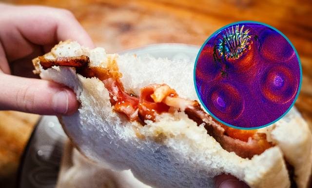 Podjadał boczek, cierpiał na migrenę. Lekarze nie mogli uwierzyć, co znaleźli w jego mózgu