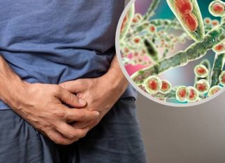 Ten grzyb jest przenoszony drogą płciową i nie reaguje na leczenie. Pojawił się także w Europie. Naukowcy ostrzegają