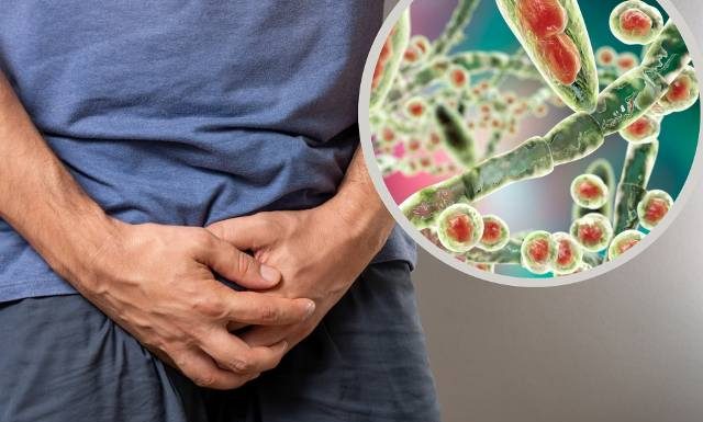 Ten grzyb jest przenoszony drogą płciową i nie reaguje na leczenie. Pojawił się także w Europie. Naukowcy ostrzegają