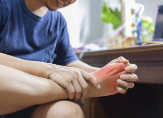 Jakie są objawy dny moczanowej? Poznaj przyczyny podagry i dietę dla osób z artretyzmem. Zobacz, jak sprawdzić czy masz dnę moczanową?