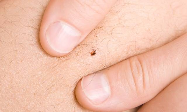 Nie rób tego, gdy ugryzie cię kleszcz. Te 5 błędów przy usuwaniu kleszcza grozi zakażeniem i rozwojem groźnych chorób. Sprawdź, czego unikać