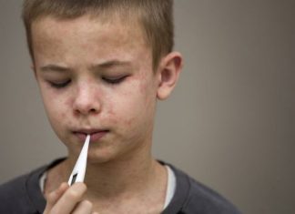 Sytuacja z odrą może wymknąć się spod kontroli? Gospodarz igrzysk olimpijskich ze wzrostem zakażeń