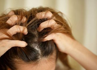 Swędzenie głowy to nie zawsze łupież, nawet gdy łuszczy się naskórek. To pomoże przy objawach problemów ze skórą głowy