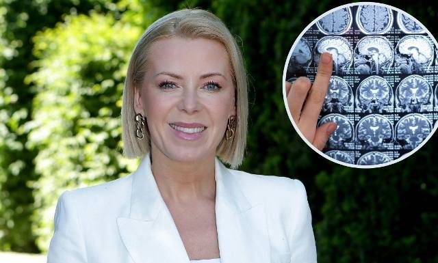 Miała guza mózgu. „Wiedziałam jak blisko aparatu mowy jest guz. Pół milimetra.” Dziennikarka przeszła poważną operację