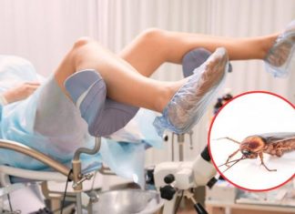 Pacjentka zgłosiła się do szpitala. Lekarze nie mogli uwierzyć, co znaleźli w jej pochwie