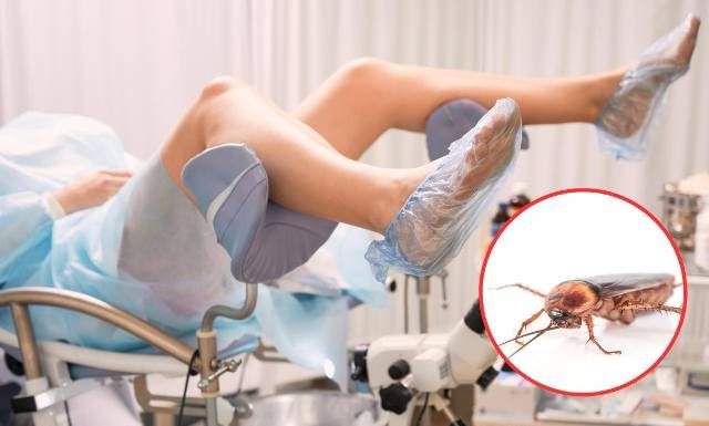 Pacjentka zgłosiła się do szpitala. Lekarze nie mogli uwierzyć, co znaleźli w jej pochwie