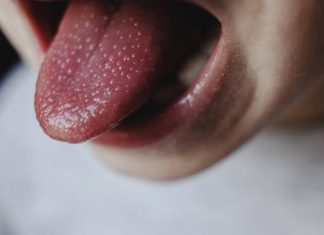 Alarmujące dane! 3,5 razy więcej zachorowań z bólem gardła i wysypką. To nie zwykła infekcja, ta choroba może skończyć się śmiercią