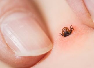 Co robić po ukąszeniu kleszcza? Sprawdź, kiedy należy jechać do szpitala i brać antybiotyk