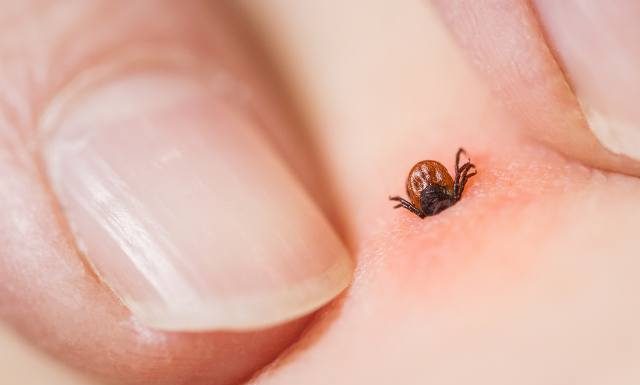 Co robić po ukąszeniu kleszcza? Sprawdź, kiedy należy jechać do szpitala i brać antybiotyk