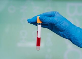 Hemofilia to choroba, z którą można normalnie żyć. Dowiedz się, czym jest skaza krwotoczna i jak ją leczyć