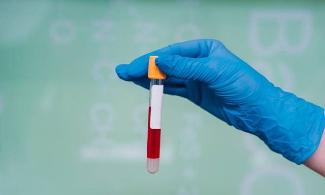 Hemofilia to choroba, z którą można normalnie żyć. Dowiedz się, czym jest skaza krwotoczna i jak ją leczyć