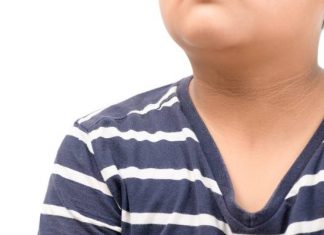 Kojarzysz takie plamy na skórze? To objaw poważnej choroby. Nie lekceważ tych zmian!