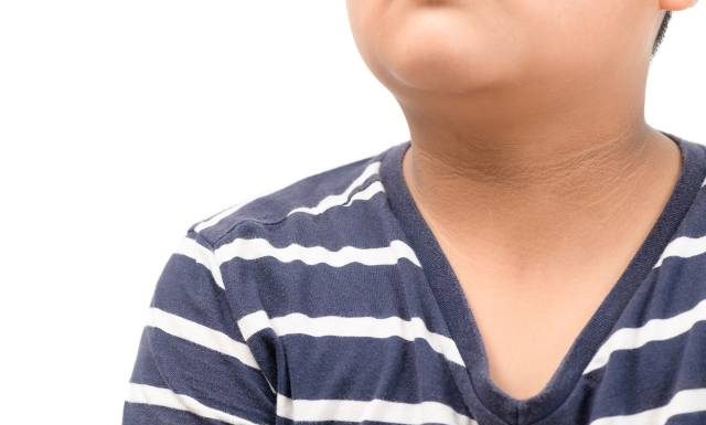 Kojarzysz takie plamy na skórze? To objaw poważnej choroby. Nie lekceważ tych zmian!