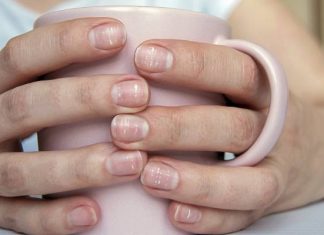 O czym świadczą białe plamy na paznokciach? Powody mogą cię zaskoczyć. Na liście m.in. manicure i leki