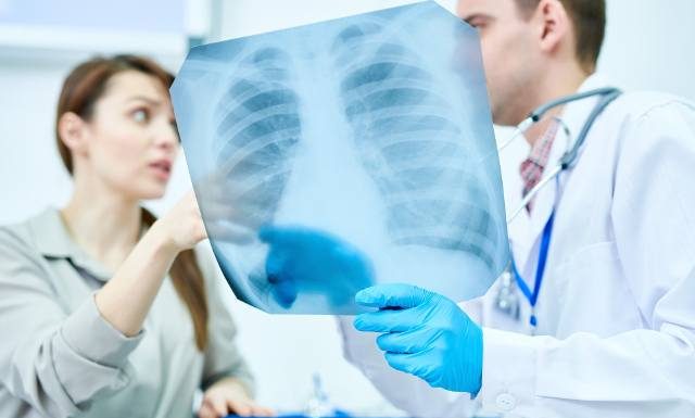 Jak rozpoznać zapalenie płuc? Objawy u dorosłych i dzieci mogą się różnić. Nie dopuść do rozwoju groźnych powikłań