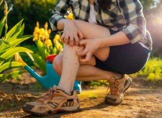 Gdy swędzi i nie daje spokoju… Te domowe sposoby na ugryzienia komarów przyniosą ci upragnioną ulgę