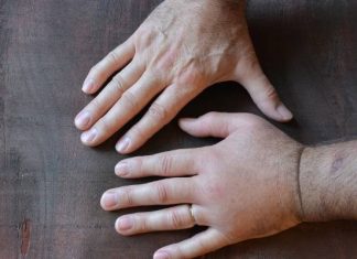 Dłonie puchną ci jak balony? To może być objaw choroby! Zobacz, kiedy występuje, by łatwiej znaleźć przyczynę problemu