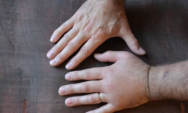 Dłonie puchną ci jak balony? To może być objaw choroby! Zobacz, kiedy występuje, by łatwiej znaleźć przyczynę problemu