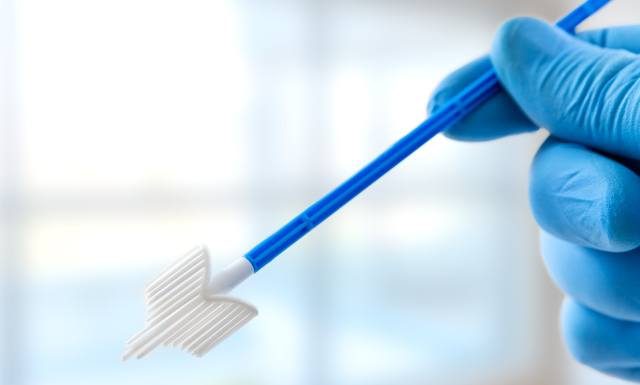 To badanie wykrywa zabójcę kobiet. Jest bezpłatne i wymagane najwyżej raz w roku. Przed rakiem szyjki macicy chronią także szczepienia