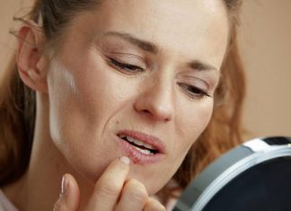 Dopadło cię „zimno”? Wypróbuj domowe sposoby na opryszczkę na ustach. W naturalny sposób zwalczą ból i inne objawy opryszczki wargowej