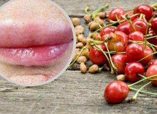 Zjadłam czereśnie i dostałam alergii. Nie zapomnę tego do końca życia. Najgorsze 30 minut, gdy nie wiedziałam, co robić