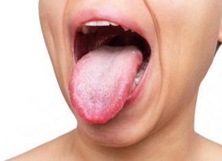 Biały nalot na języku nie zawsze jest normalny. Zobacz, kiedy to niegroźna zmiana, a kiedy objaw poważnej choroby