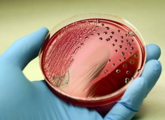 Salmonella to groźna bakteria nie tylko z żywności. Zobacz, jakie są objawy zatrucia Salmonellą, jak uniknąć zakażenia oraz jak je leczyć