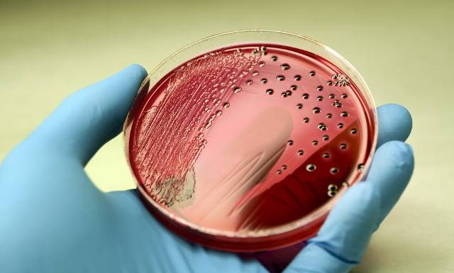 Salmonella to groźna bakteria nie tylko z żywności. Zobacz, jakie są objawy zatrucia Salmonellą, jak uniknąć zakażenia oraz jak je leczyć