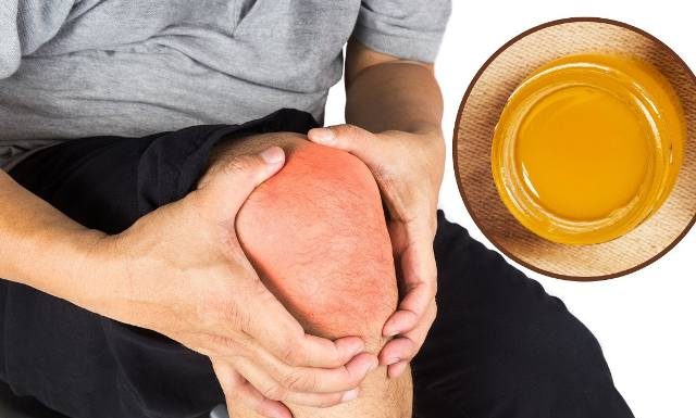 Najlepsza maść na stłuczenia i opuchliznę. Kupisz w aptece za grosze. Maść arnikowa naturalnie leczy siniaki i krwiaki