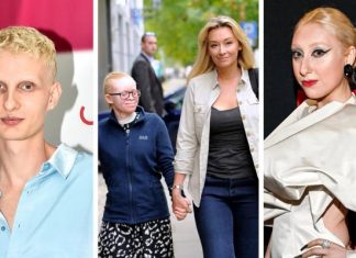 Albinosi są wrażliwi na promienie słoneczne. Tę cechę genetyczną ma m.in. Luna i córka Martyny Wojciechowskiej