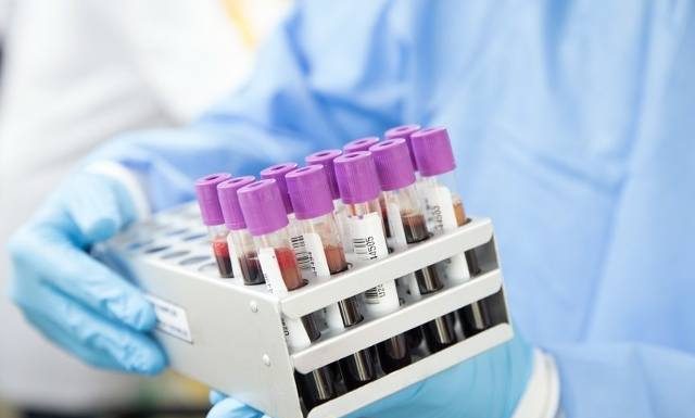 Strach w Stanach Zjednoczonych. Potwierdzono przypadek dżumy u człowieka. Wracają choroby uznane za wymarłe?