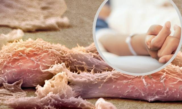 Te guzy są złośliwe i szczególnie szybko rosną u dzieci. Nie ma specjalnych badań na ich wykrycie, warto znać więc objawy