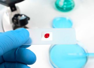 Wystarczy kropla krwi. Nowy test wykryje ponad 60 różnych chorób. Badanie może przewidzieć rozwój stwardnienia rozsianego czy chłoniaka