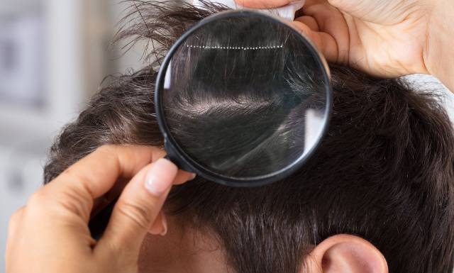 Atakują nie tylko dzieci. Skąd się biorą wszy ludzkie i jak wyglądają? Sprawdź, jakie są objawy wszawicy i jakie preparaty na wszy stosować