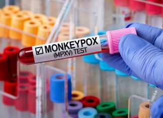 Możliwe zagrożenie o zasięgu międzynarodowym! WHO zwołuje specjalny komitet w sprawie wirusa mpox