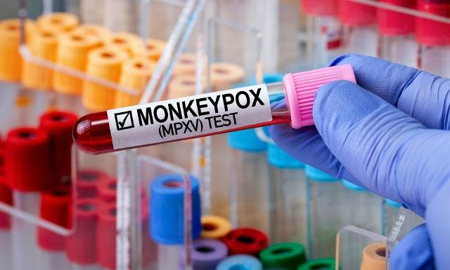 Możliwe zagrożenie o zasięgu międzynarodowym! WHO zwołuje specjalny komitet w sprawie wirusa mpox