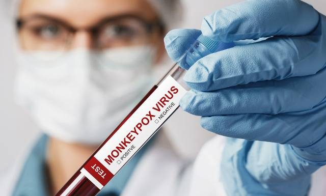 Nie grozi nam kolejna pandemia? „Małpia ospa nie jest nowym COVID-19”. WHO zapewnia, że wirus jest pod kontrolą