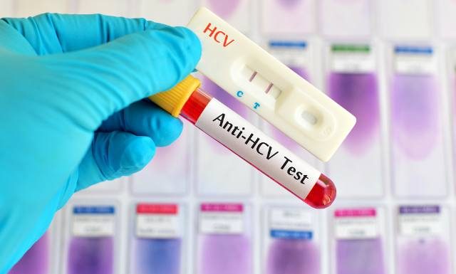 Nie leczysz infekcji? Po latach chorujesz. Tymczasem „nigdy wcześniej nie było tak łatwo wygrać z tym wirusem”. Badania zrobisz za darmo