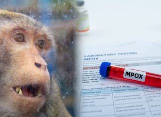 Tym osobom zalecana jest szczepionka mpox. Wydano oficjalne polskie zalecenia dotyczące ochrony przed małpią ospą