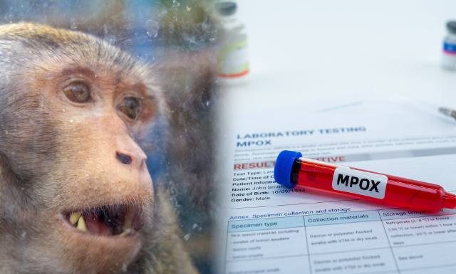 Tym osobom zalecana jest szczepionka mpox. Wydano oficjalne polskie zalecenia dotyczące ochrony przed małpią ospą