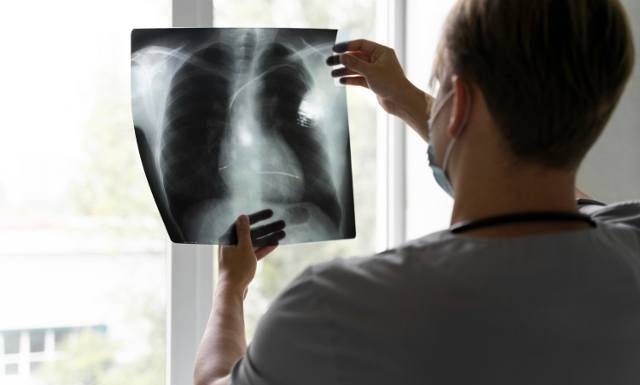 Już nie COVID-19. Ta choroba jest najczęstszą przyczyną śmierci z powodu choroby zakaźnej. WHO ostrzega. Poznaj 5 czynników ryzyka